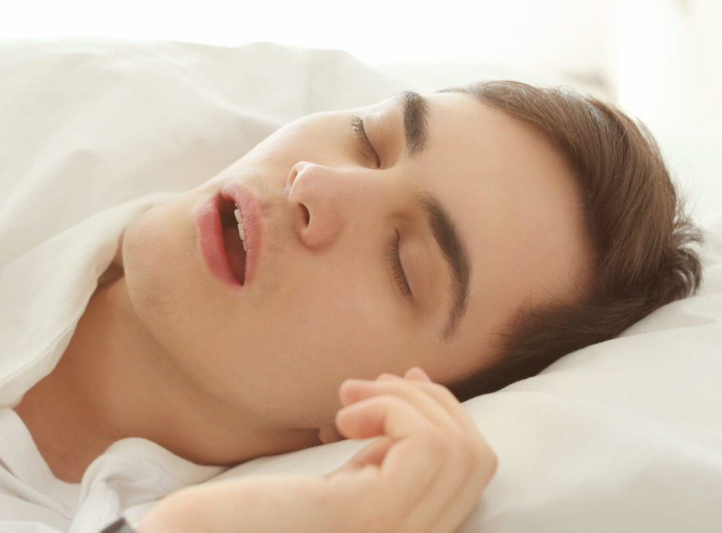 sleep apnea sleep apnea