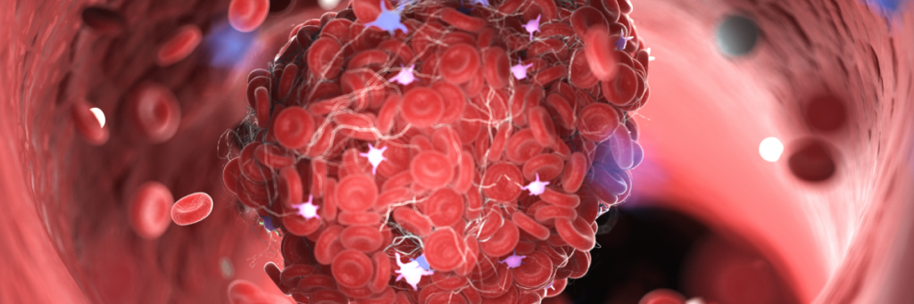 Blood clotting Blood clotting
